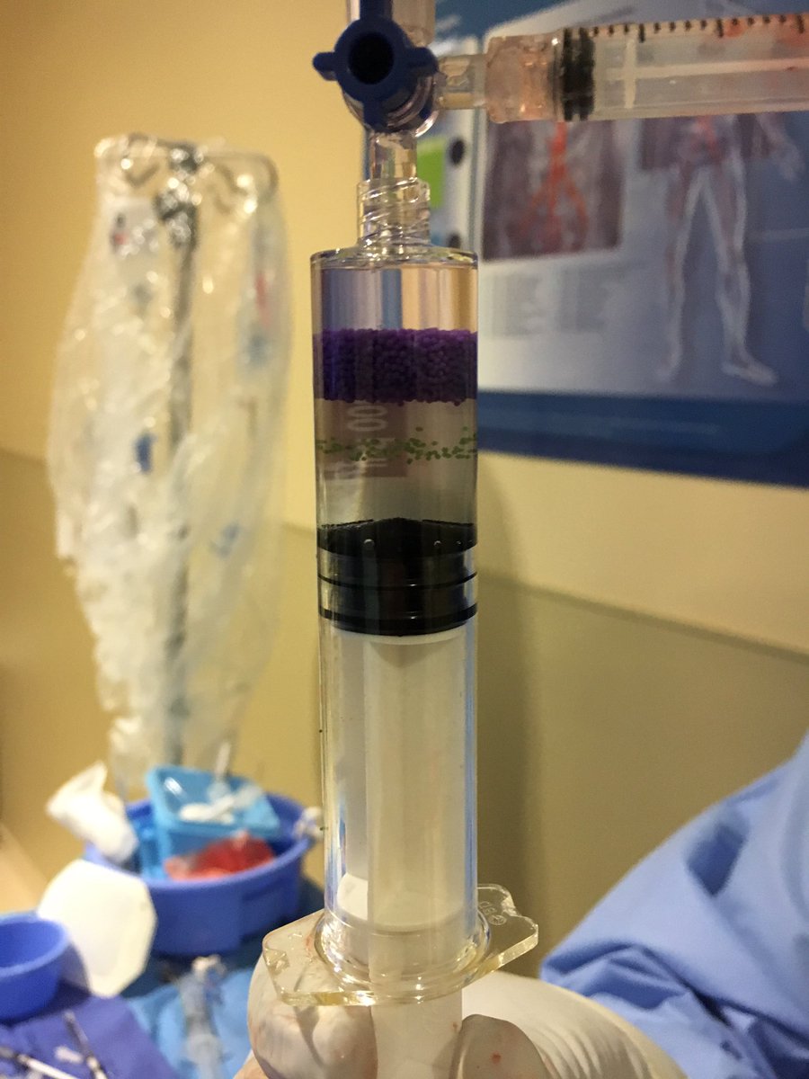 Team_VIV's tweet photo. #beads buoyancy affected by particle size. #embozene 900 rise. See the small amount of 700 micron just below. @randredel @BostonPIMedEd https://t.co/fsr12SPUFJ