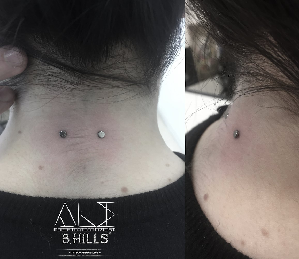 bhillstattoo's tweet photo. • NAPE FRESH DONE •
Piercer Resident Artist @AleBhills
#BhillsTattooCompany
#AleModificationArtist
#Titanium
#Piercing
#Surface
#Nape https://t.co/QmKiTPB46H