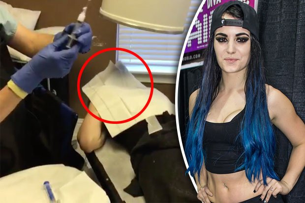 WWE Diva Paige In Shock Doctor Visit After Sex Tape Ordeal Daily S