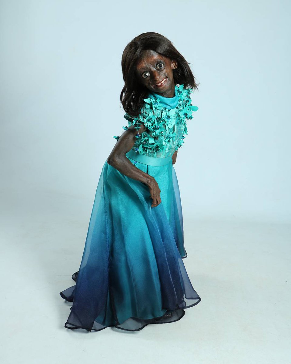 HlengiweMotaung's tweet photo. While doctors predicted she would only live until the age of 14, Phalatse celebrated her 18th birthday in March. #RIPOntlametse https://t.co/lDnUWuFWAy