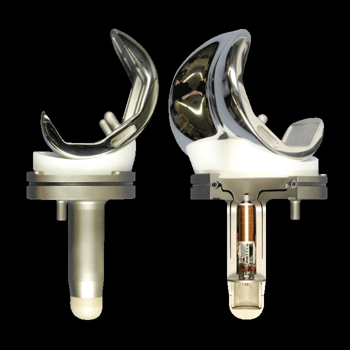 ExoPathLabs's tweet photo. Here is cost details of Total Knee Replacement surgery in Noida 
click here <https://t.co/rsp4B7RPNK>
#KneeReplacement #Surgery https://t.co/ZXUcHO5ezJ