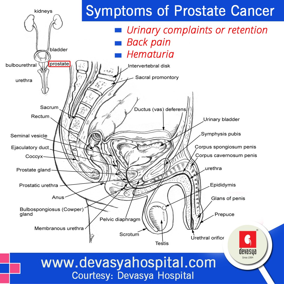 KidneyHospital's tweet photo. #Prostate #cancer is the most common cancer in #Males. If you show any symptoms, visit at https://t.co/aEQp42rR8X,
#DevasyaHospital https://t.co/5GUaKNYQMO