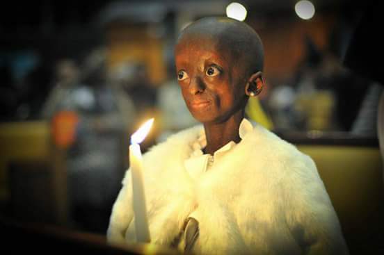 Ema_Morogong's tweet photo. Doctors said 14, God said 18.  #RIPONTLAMETSE https://t.co/8l5jgJg1xz