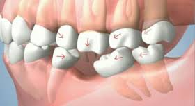 Capital_Implant's tweet photo. Remplacer une ou plusieurs dents : quelles sont les différentes options ?
https://t.co/HhDPjuJcVv
#nouvelledents #implantdentaire https://t.co/5d2fUvE2YW