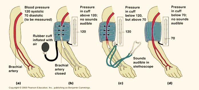 طريقة قياس ضغط الدم