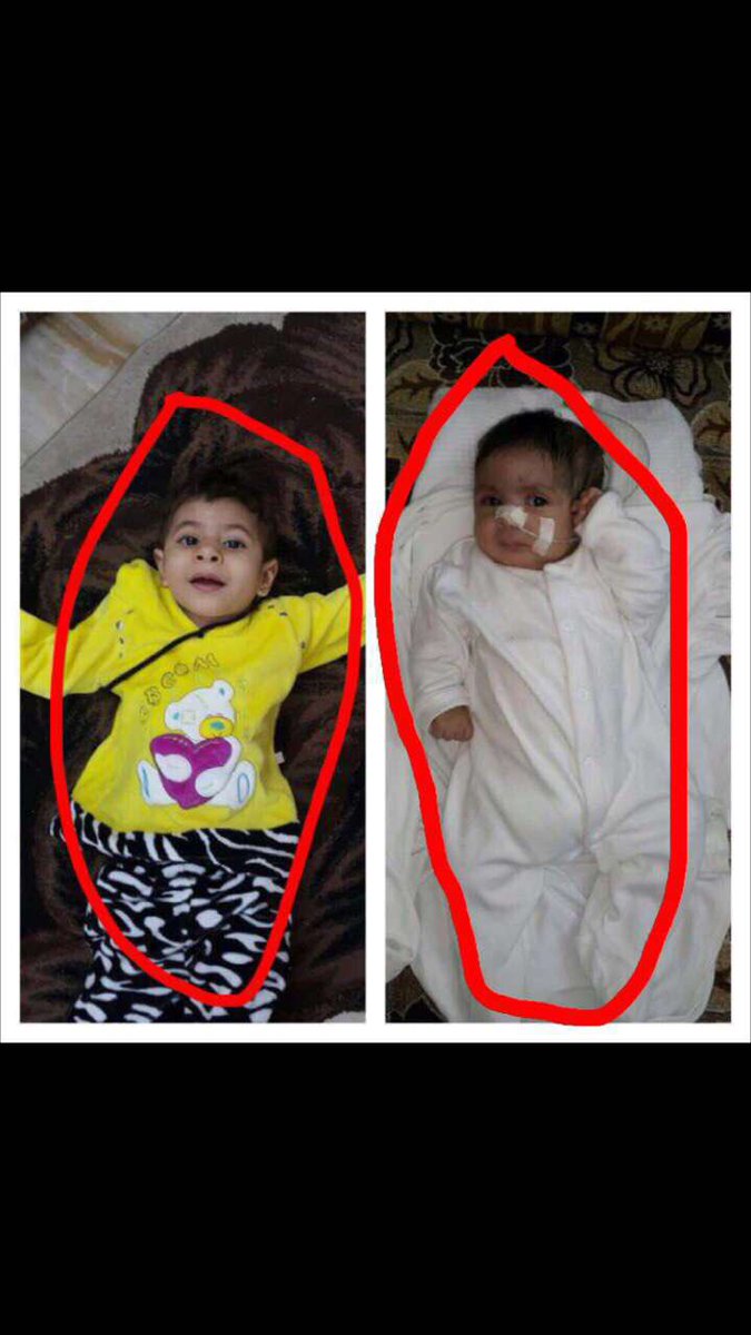 bx_y2's tweet photo. #حزب_زقومبي_وصل 😴✌🏻️ . #نطالب_بعلاج_ايلاف_و_تالين_2 https://t.co/illxYo1pH3