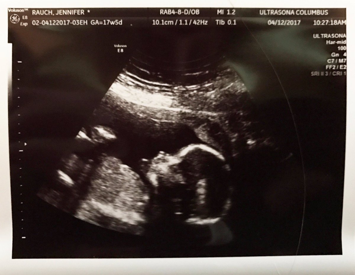 MartinDigital's tweet image. 10 fingers and 10 toes, and only 5 months to go!!