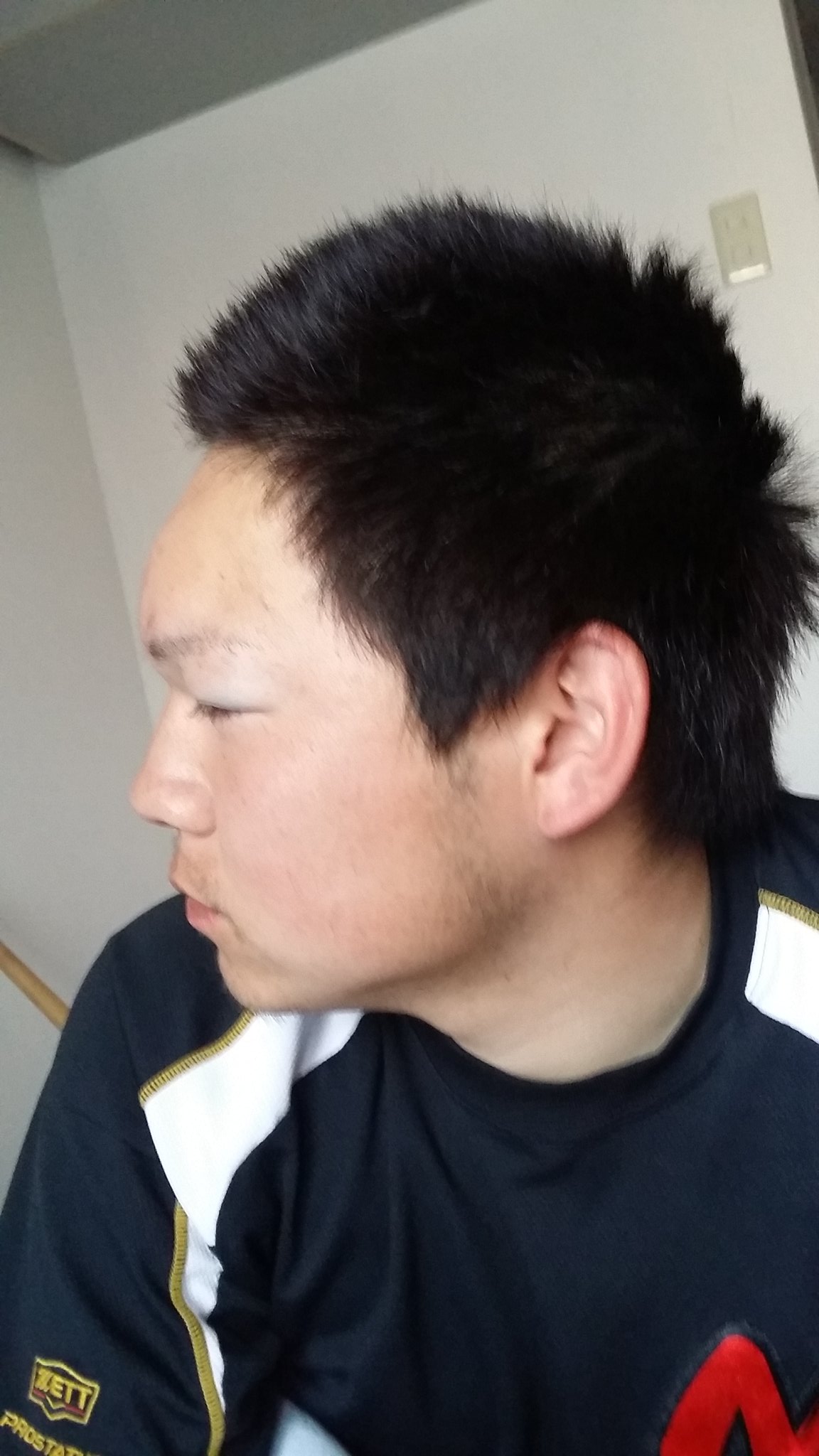 樋口祐作 Na Twitteru 練習中に鼻の上にボールが当たって陥没骨折した 手術せんばなおらんって 大学入ってそうそうついてねー笑 ってか手術こえー 樋口祐作 Na Twitteru 練習中に鼻の上にボールが当たって陥没骨折した 手術せんばなおらんって 大学入ってそうそうついてねー笑 ってか手術こえー