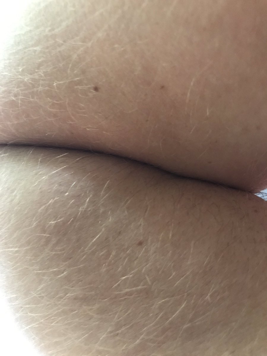 derricksechrist's tweet photo. @dennysgrandsam @tacobell  ass or elbow? https://t.co/EVp5qqhdlM