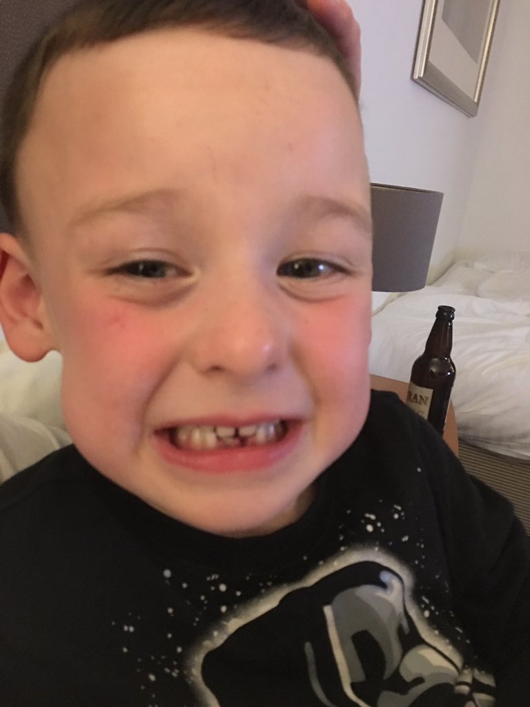 MoffatLee's tweet photo. So first tooth fell down the toilet and he's just swallowed the second tooth 😳 #toothfairychallenge https://t.co/TAHa9kZicv