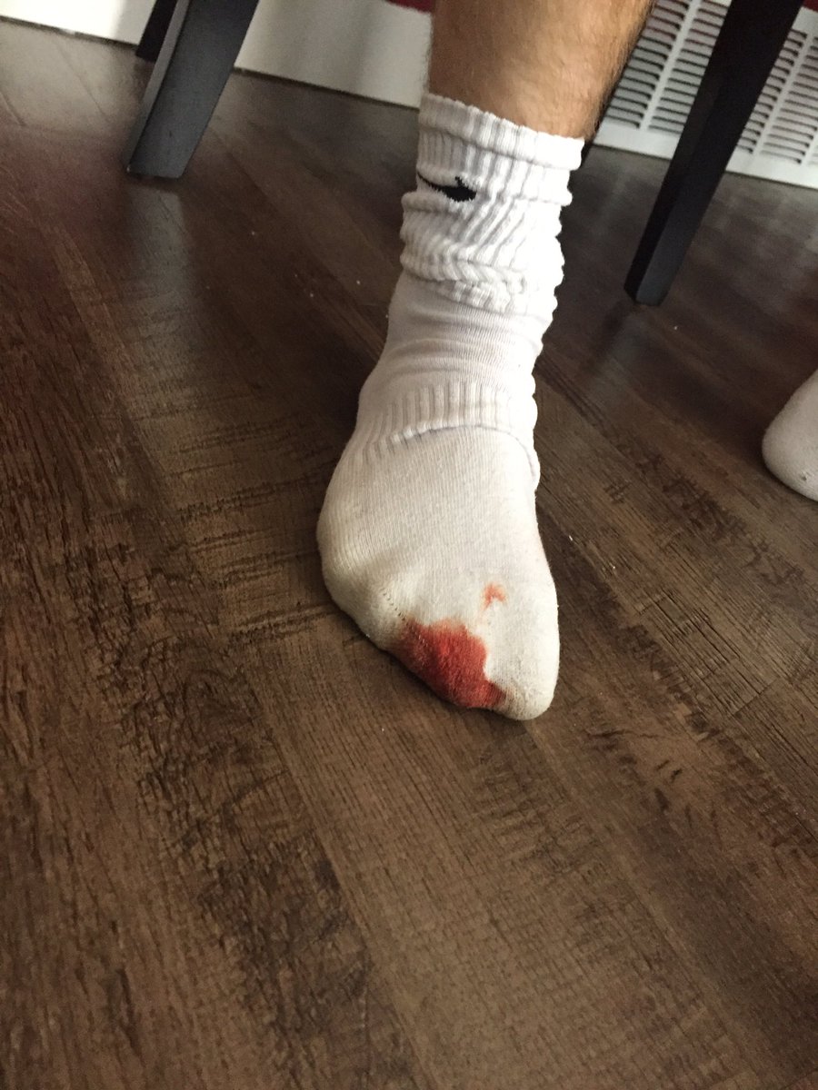CJLuttenegger's tweet photo. @2v2ABL going 0-3 in a double elimination bracket doesn't come without pain and punishment. @connorfarrell15 battled hard today. https://t.co/P7laweFlDd