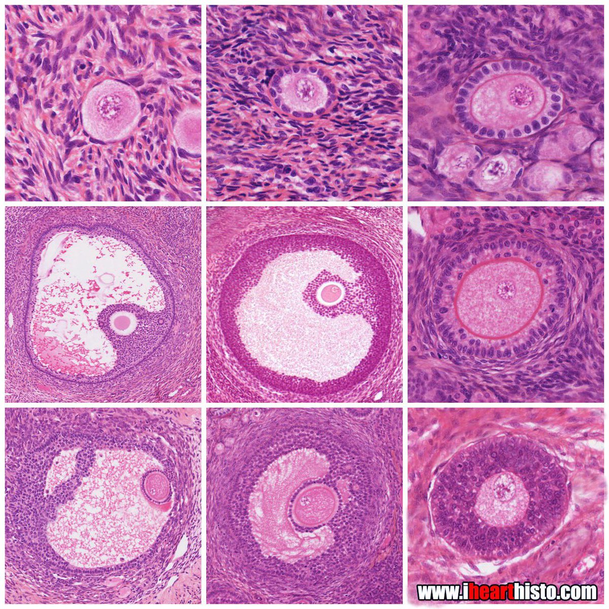 IHeartHisto's tweet image. 🥚🤰Human Easter Eggs🤰🥚
Hope your weekend is a-yolk-ay!
(follicle dev: spiral from top left)
#histology #pathology #pathologists #HappyEaster