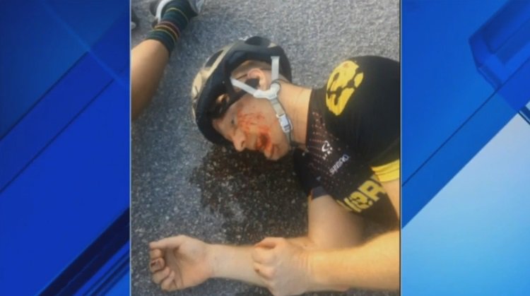 Anthony Napoliello survived, but he'll have to live with metal plate on his hip bit.ly/2pkaWdC https://t.co/nXYoNwJio7