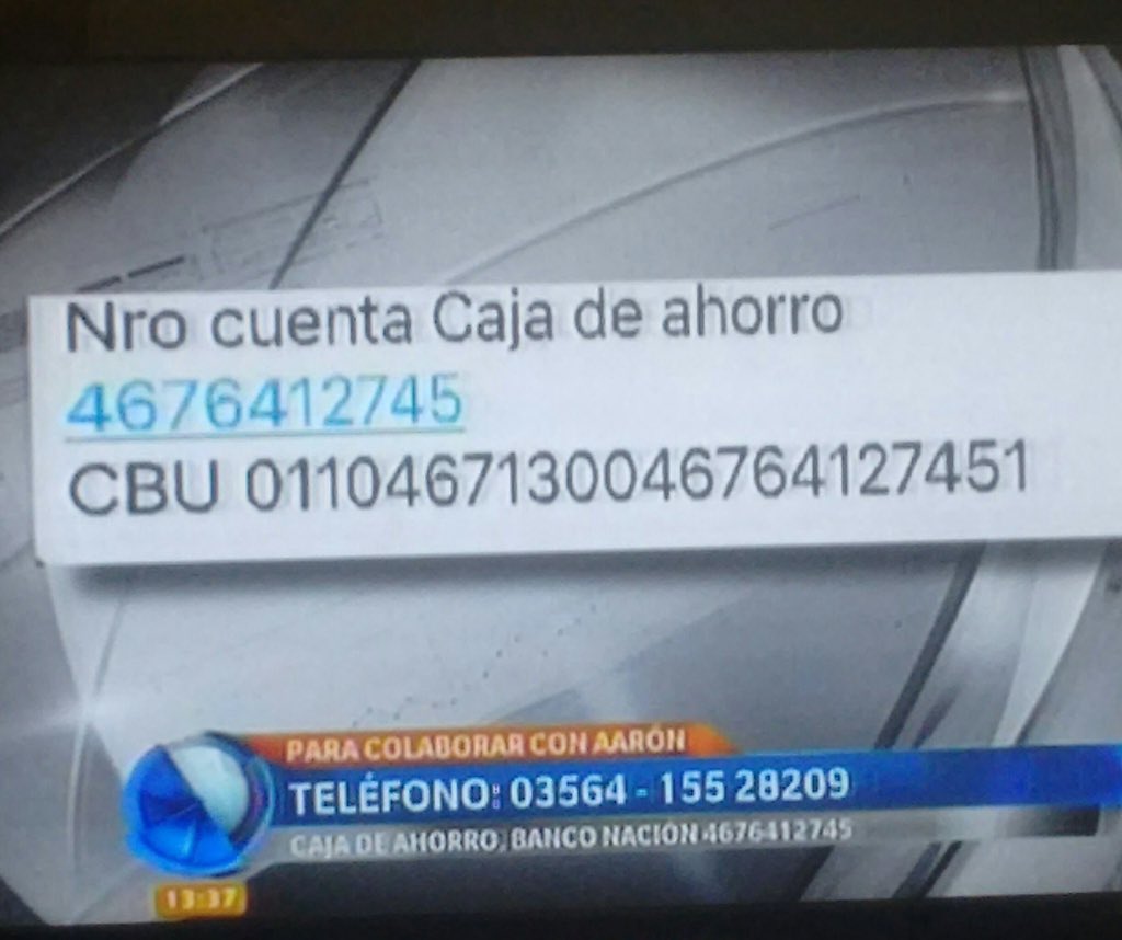 camucha4's tweet photo. Tiene 5 meses y sufre del síndrome de Johanson Blizzard, es el único caso en Argentina. Ayudemos a su familia que lo necesita!!! #unidosar https://t.co/eF2993V69u