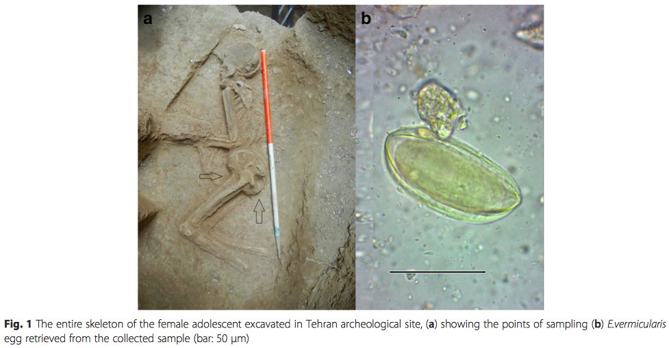 enterobius vermicularis ncbi)