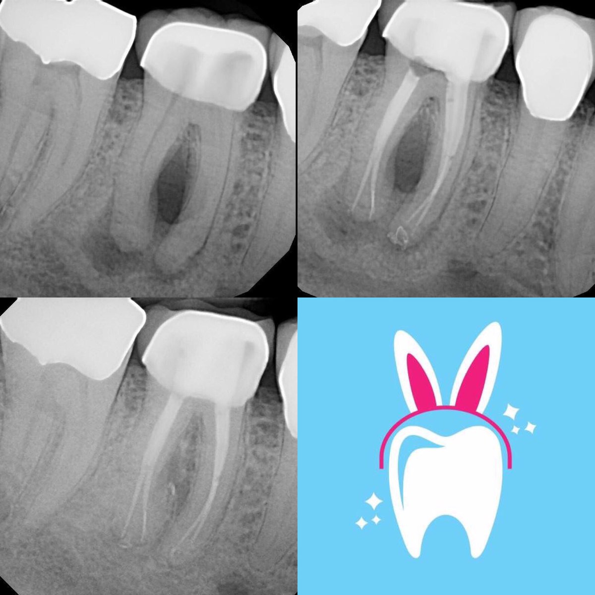 DrRicoShort's tweet photo. Happy Easter from Dr. RicoShort & Staff at Apex Endodontics P.C!
#RootCanalsRock
#RootCanalsWork
#RelaxDontExtract https://t.co/aZmE3vPaMJ