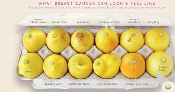 Le_gouteur's tweet photo. Cancer du sein : des citrons pour apprendre à le dépister #alimentation  https://t.co/BpahOtAJgm https://t.co/pzoIxkQp8M