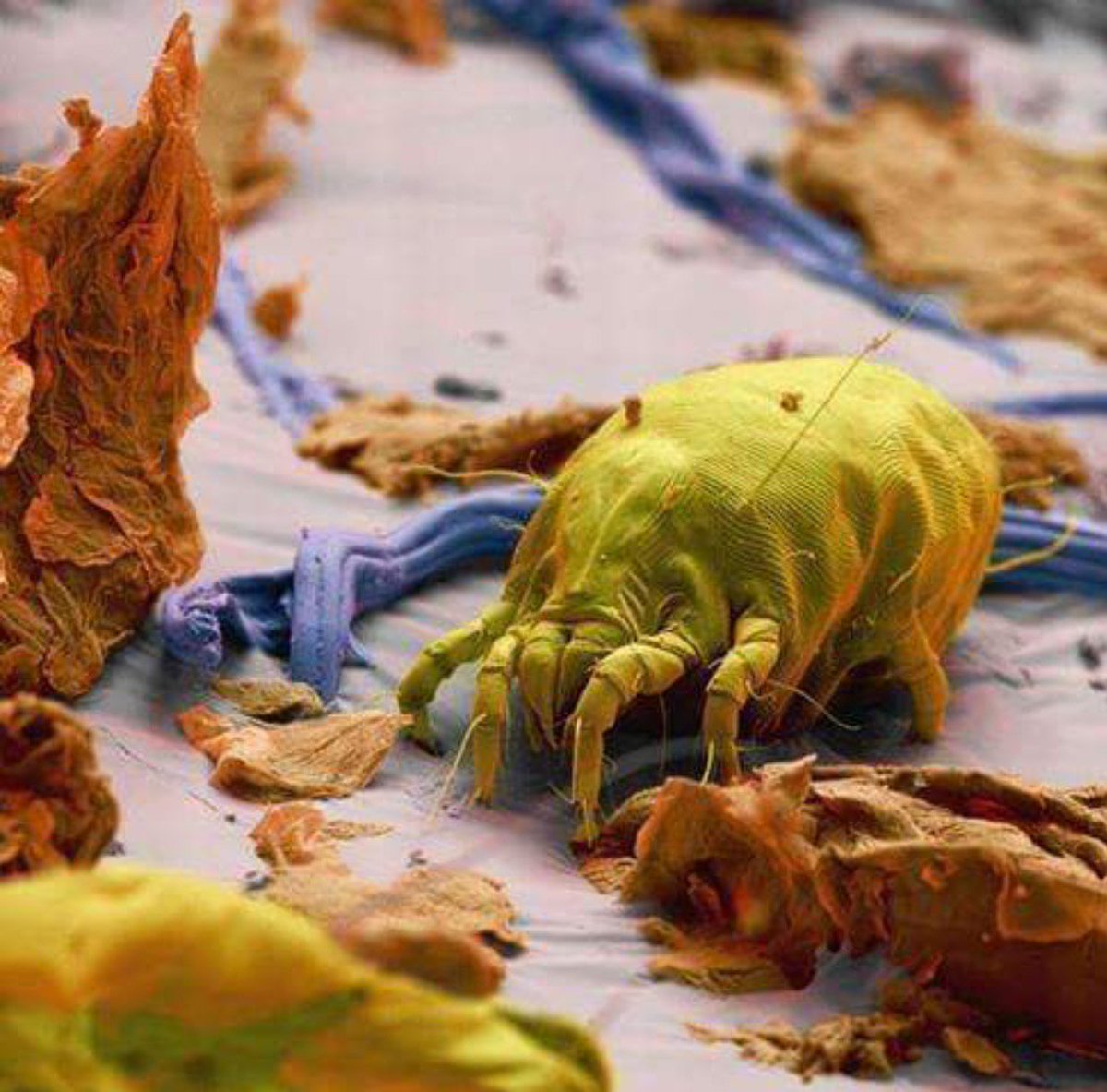 Perfectoneclean's tweet image. Here is a magnified image of a dust might eating dead skin cells on a mattress!
perfectoneclean.com