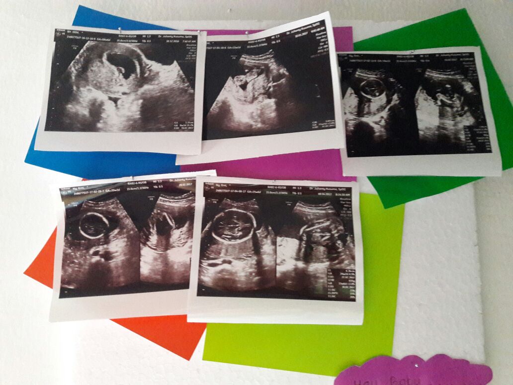 Nieflove's tweet photo. Hayy baby... sehat terus ya sayang  😘😍 https://t.co/2Zrzykhb64