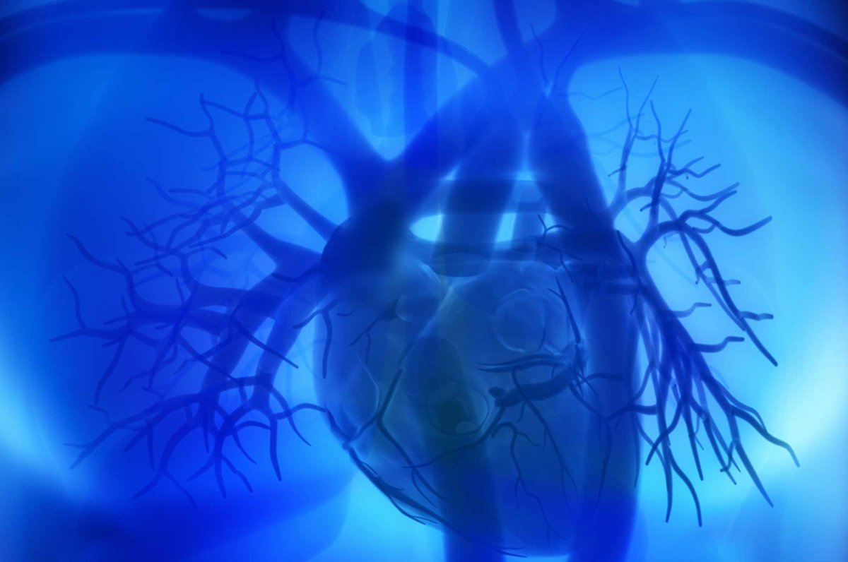 WeAreImpactLaw's tweet photo. "Timeline of the #IVC Filters Lawsuit" ==> https://t.co/pMpshVCwmW #DefectiveDevices #ProductLiability https://t.co/wGPKDC6Nzd