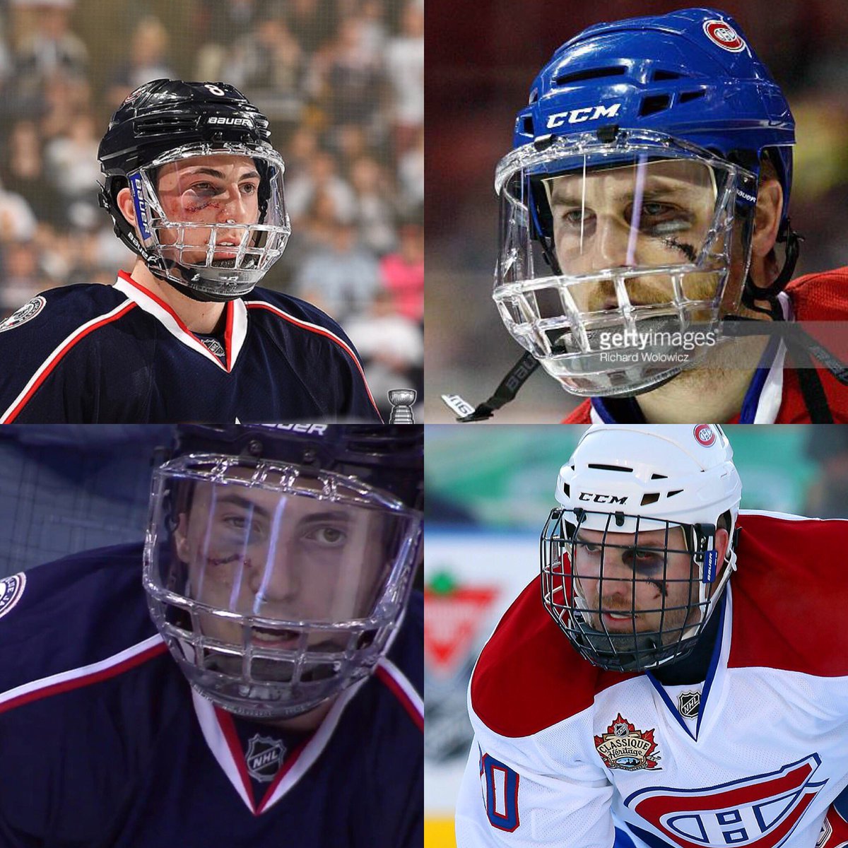 jameswisniewski's tweet photo. Kind of brings back some old memories! Stay strong my fellow #pollack #nhl #manssport other athletes would be out indefinitely https://t.co/CEEvdGT6eM