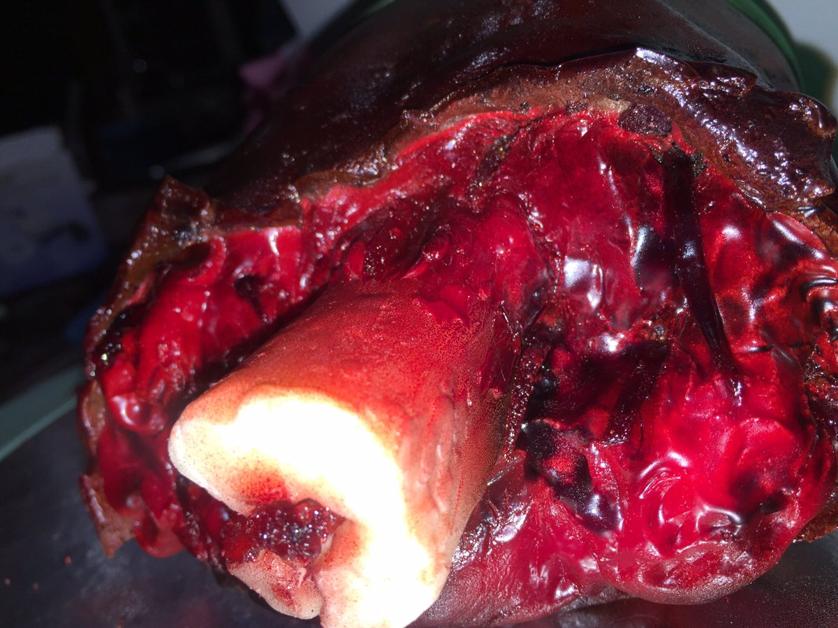 DearCakeCT's tweet photo. Gruesome amputation cake for a surgeon. #cake #bake #bakingbliss #medicalcakes #reallife https://t.co/VgRODQDh0P
