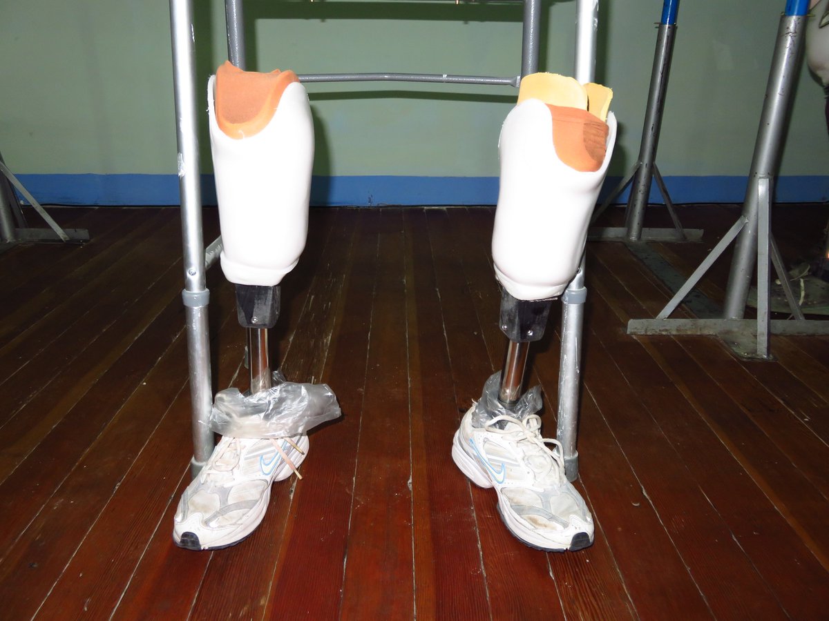 FUNPROBO's tweet image. A taxi driver, lost his legs and so couldn't drive anymore.  Now with new legs, he is driving his taxi again.