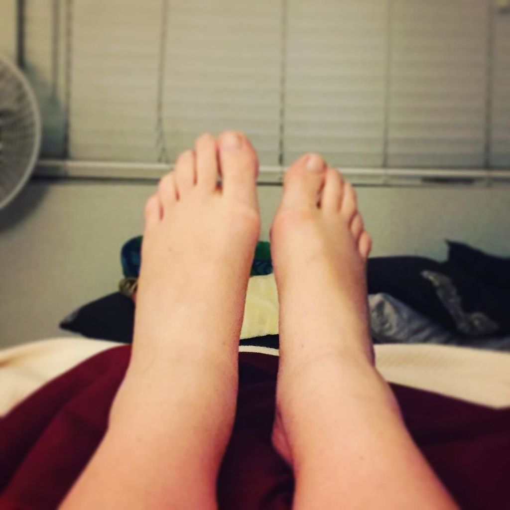 mauisadie's tweet photo. Some days I can feel it coming other days I get home and look down and my ankles are swollen. #PregancyProblems https://t.co/zpE9fEWdbh https://t.co/oZCGffFVN7