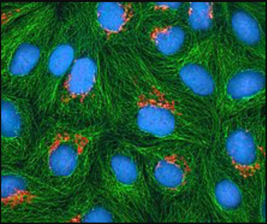 DrHowardJones's tweet photo. HeLa cells have led to many scientific breakthroughs and saved so many lives. #nhshenrietta #HeLa https://t.co/79ztGEEjc4