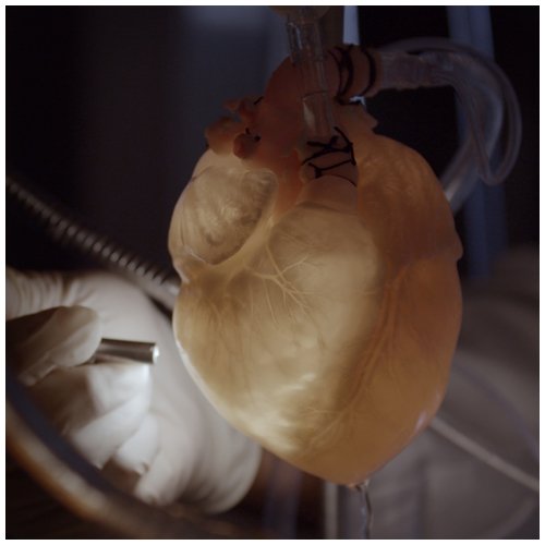 TODAY WE LAUNCH the official YOUTUBE CHANNEL for THE TRANSPLANT PROJECT - PLEASE SUBSCRIBE &amp; SHARE!  ow.ly/Fvrn30aRESd  #transplantdoc