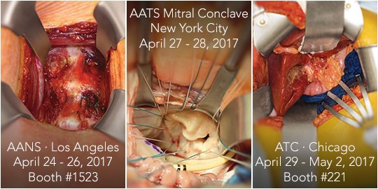 ThompsonRetract's tweet photo. Come see us at next week’s meetings!
@AANSNeuro #AANS17 booth 1523
@AATSHQ #MitralConclave17
@ATCMeeting #ATC2017Chicago booth 221 https://t.co/S7Nl6VfW3n