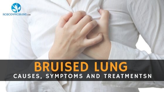 nobodyproblems's tweet photo. Bruised Lung: causes, symptoms and treatments
https://t.co/3crOMBXH4l
#Bruised_Lung https://t.co/udTsKYvNYn