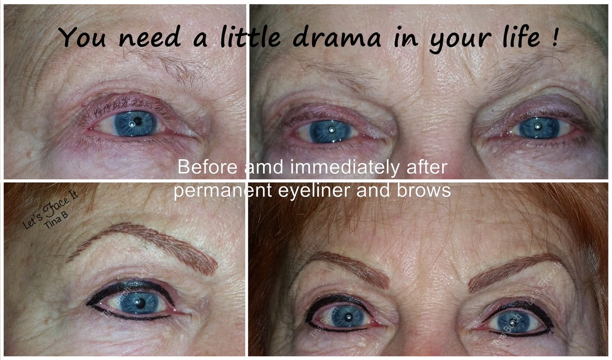 letsfaceittinab's tweet photo. #letsfaceit #microbladingkc #permanenteyeliner #microblade #permanenteyebrows #browtattoo https://t.co/uEFBPB3MKB