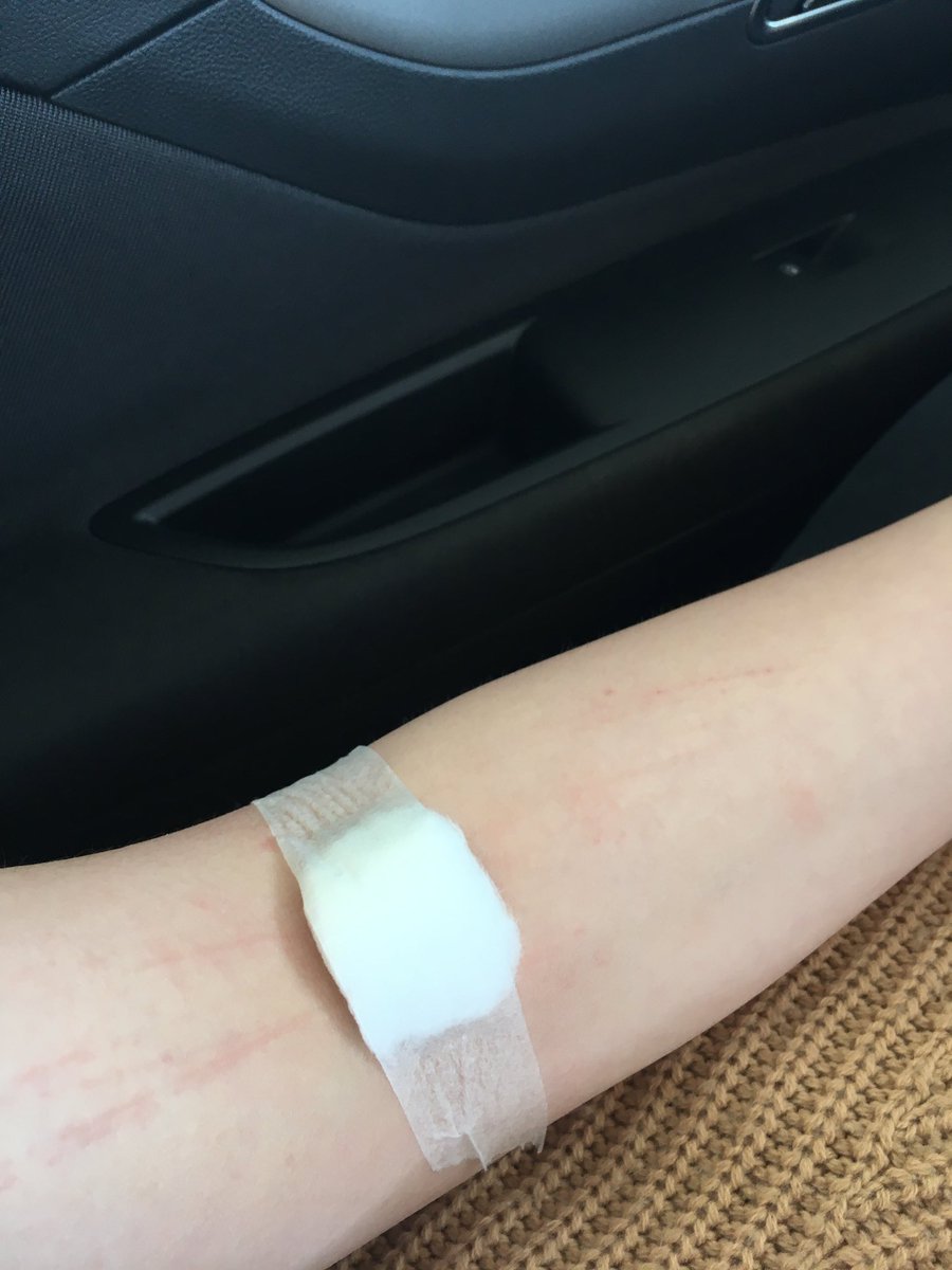 leonieduffield0's tweet photo. So I had a mental break downπππ had to get 4 tubes taken think the nurse hated me πππ #causingascene https://t.co/rmjM6jlwiz