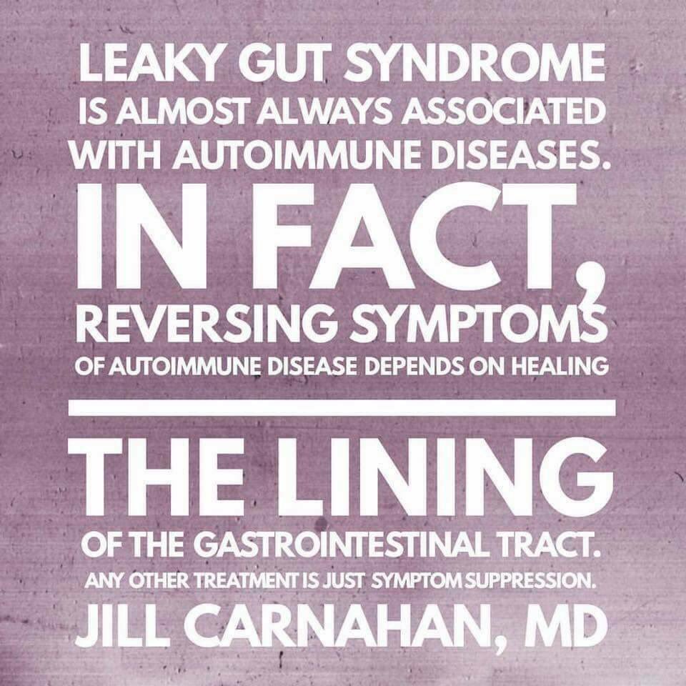 kurtzsarewe's tweet image. This! #plexuscanhelp