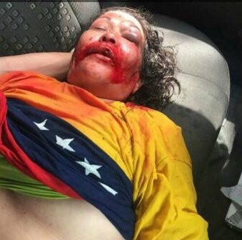 LigiaDelfin's tweet photo. #URGENTE Irma Bello señora de 50 años fue AGREDIDA con el chorro d una tanqueta por la GNB en la protesta de #Guayana, DESGRACIADOS https://t.co/MHjWvhKE9I