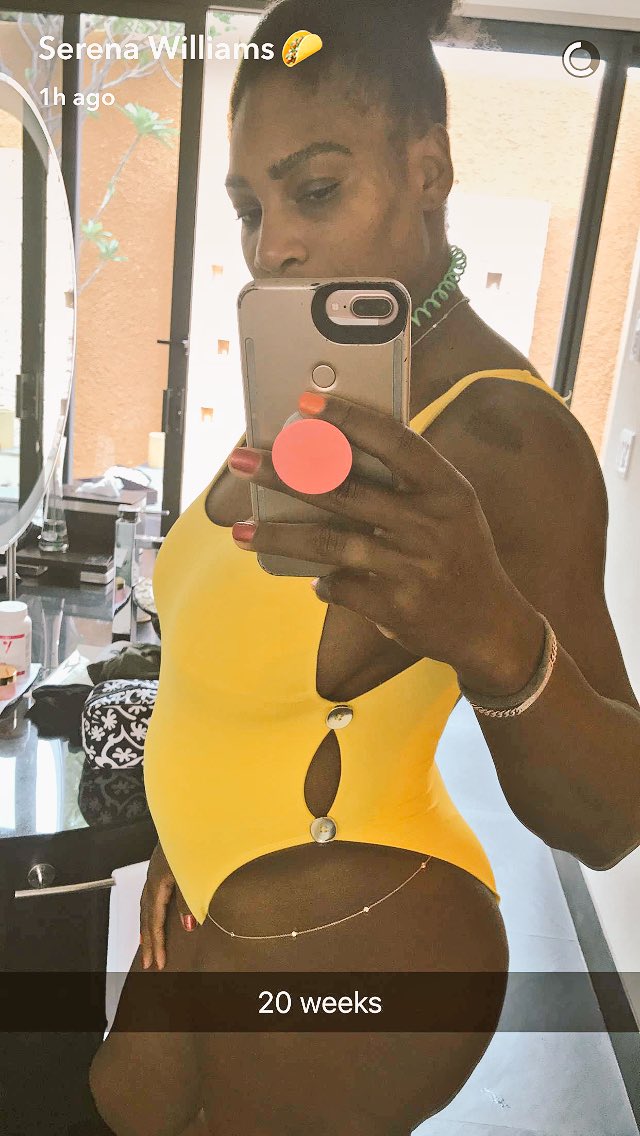 WordOnDStreet's tweet photo. @WordOnDStreet - Congratulations to @serenawilliams and her fiancé @alexisohanian on their pregnancy #reddit #tennis #SerenaWilliams #celeb https://t.co/lKdWMNn9x7