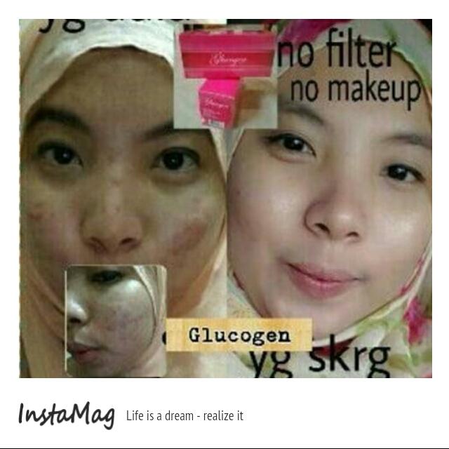 Putih ga cm dimuka tp slruh bdan,ga sembarng putih jg tp putih sehat itu wajib,putihny dpt sehatny jg dpt cm glukogen