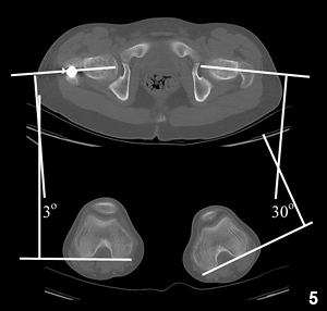 Scirp_Papers's tweet photo. Anatomical Relationship of the Femoral #Anteversion and Distal Femoral #Rotation #tomography
http://t.co/8AFnyEJIM6 http://t.co/jcf1H01GCI