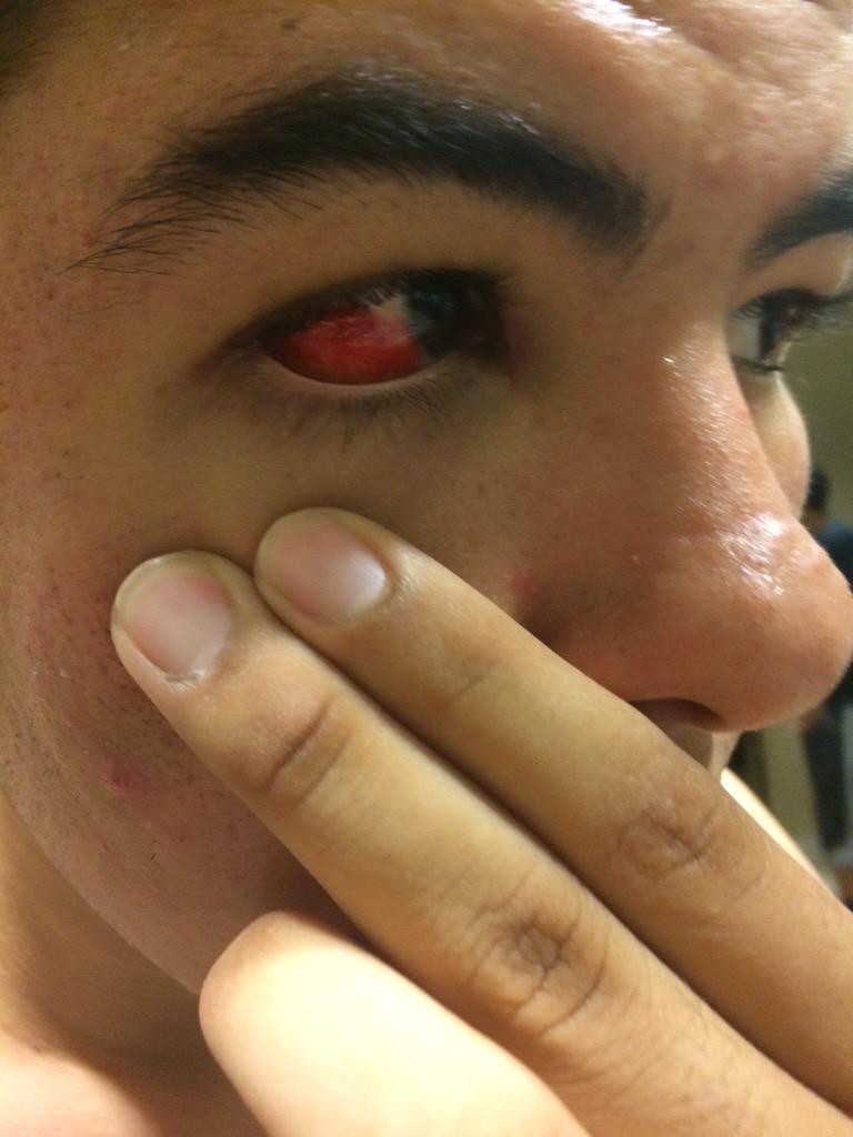 Official_RRD's tweet photo. When u eat out a girl on her period and some gets in UR eye 😂😂😂 JKJK #MyEye #zombieShit http://t.co/Qblo2u2EQS