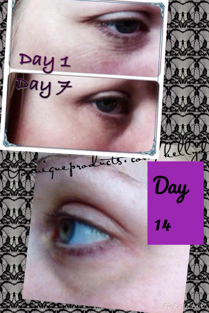 Youniquekd's tweet photo. Wow look at the results!!!! Uplift Eye Serim is amazing!!!!! Message to order @KarisseJane @LauraTringham pls Rt http://t.co/v6BIavDce7