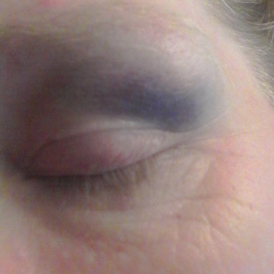 MissfitsRD's tweet photo. This weeks Tuesday Bruise-Day goes to Jenneration Wrecked!!! #missfitsrd #missfits #derbyrules #derbygirls #derbylove http://t.co/4yZEImOI75