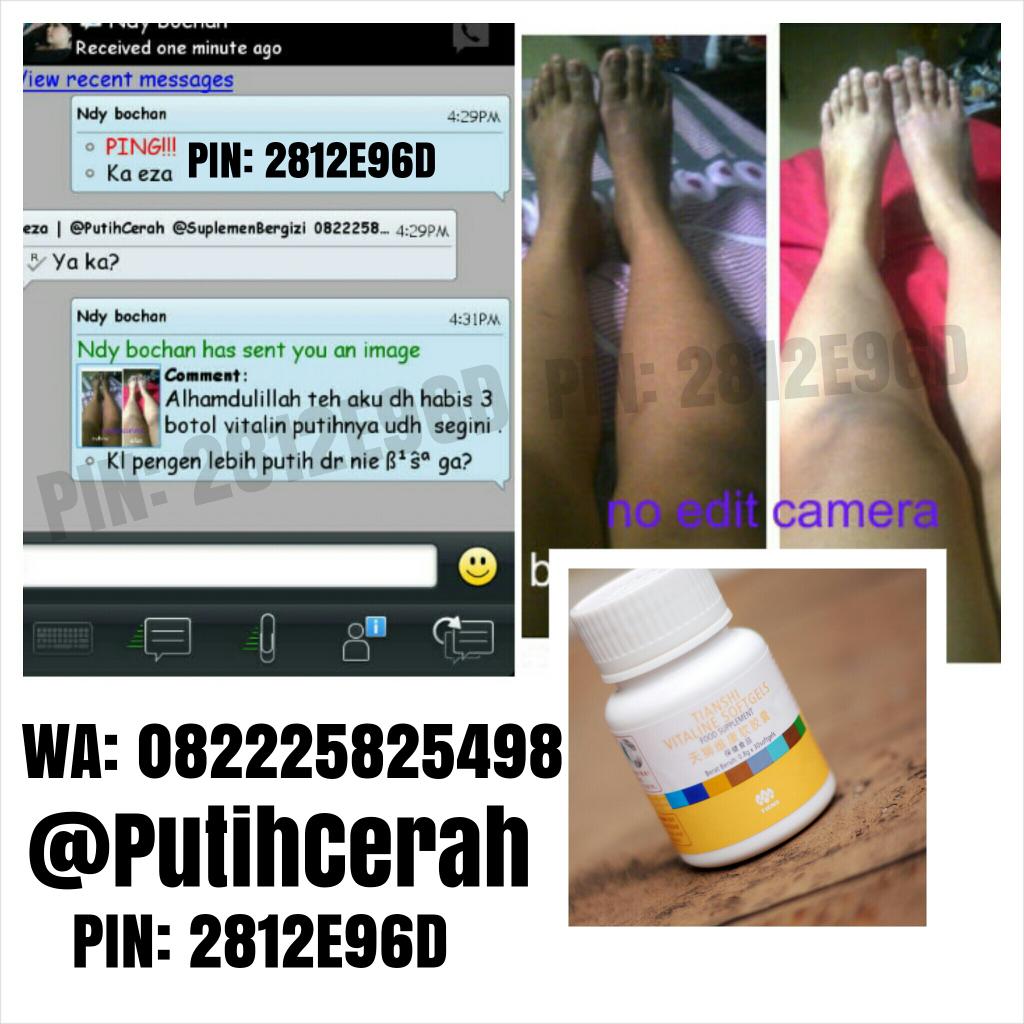 SuplemenBergizi's tweet image. #testimoni ka ndy yang udah konsumsi vitaline. Kelihatan banget perubahannya. Sudah lebih putih 😍. Mau? Pin: 2812E96D