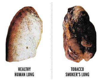 lungs tar smoker vital