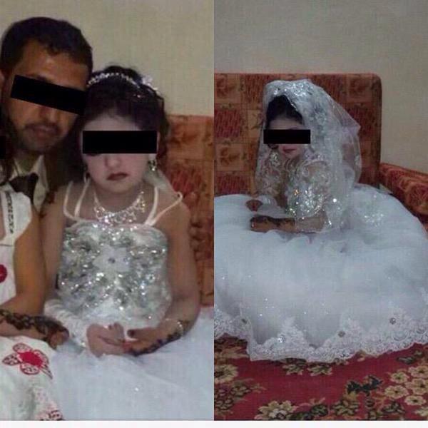 Первая брачная ночь в исламе. Первая брачная ночь в Йемене. 8-Летняя невеста в брачную ночь. Брачная ночь маленьких детей. 8 Летняя невеста из Йемена.