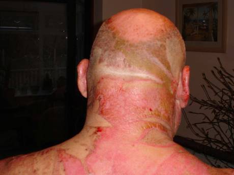 Independent's tweet photo. Woman who tried to 'boil husband' jailed
http://t.co/LikPkGpE8J http://t.co/wuoXHlsiZo