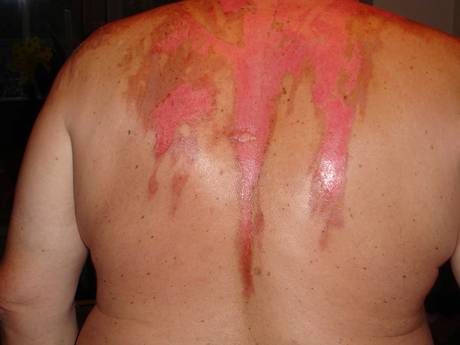 Independent's tweet photo. Woman who tried to 'boil husband' jailed
http://t.co/LikPkGpE8J http://t.co/wuoXHlsiZo