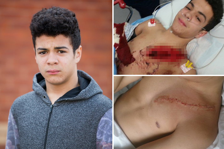 DailyMirror's tweet photo. This horrifying picture shows how unprovoked knife attack nearly killed teen http://t.co/DHlO8MKk0O http://t.co/YPYoxbQ7ui