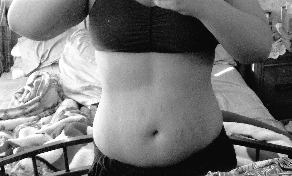 SadRelapsed613's tweet image. Fuck stretch marks. Fuck being fat.