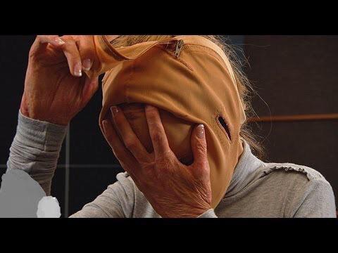 MrDunneWatts's tweet photo. This Girl Removed Her Mask After 2 Years...These 9 Photos Will Leave You Speechless
here → http://t.co/2NBnQayTmN http://t.co/0uUqzxDH4Y